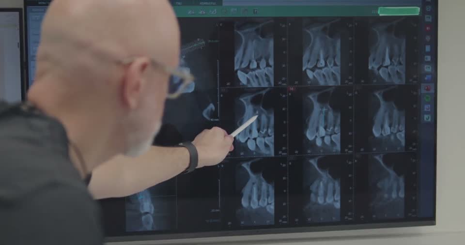 Dr Niewada omawia z pacjentem wynik tomografii CBCT na ekranie diagnostycznym