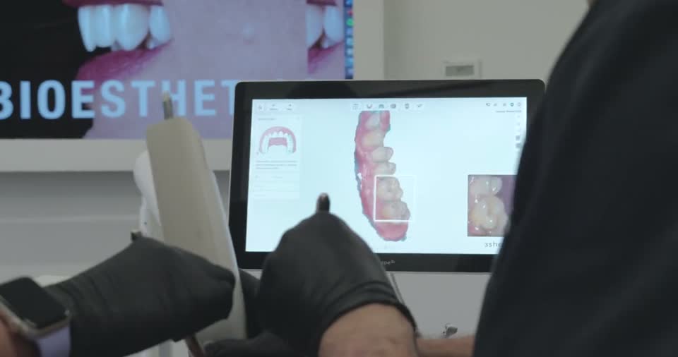 Cyfrowe planowanie leczenia: skan wewnątrzustny i projekt uśmiechu na ekranie
